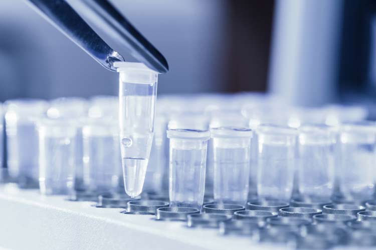 BioCryst Pharmaceuticals, Inc. (NASDAQ:BCRX) Under Analyst Spotlight BioCryst Pharmaceuticals, Inc. (NASDAQ:BCRX) Under Analyst Spotlight